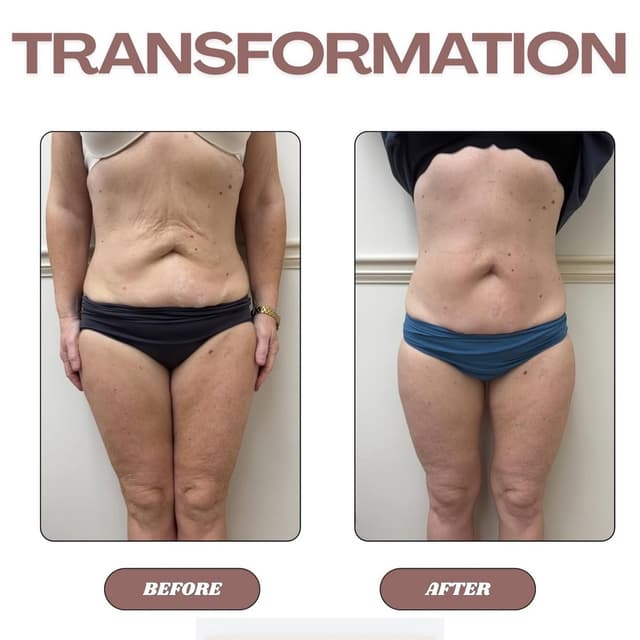 Contour and Spraytan Glow Package at Glo Lux Aesthetics in Tulsa, OK